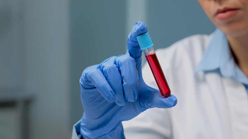Hematologie