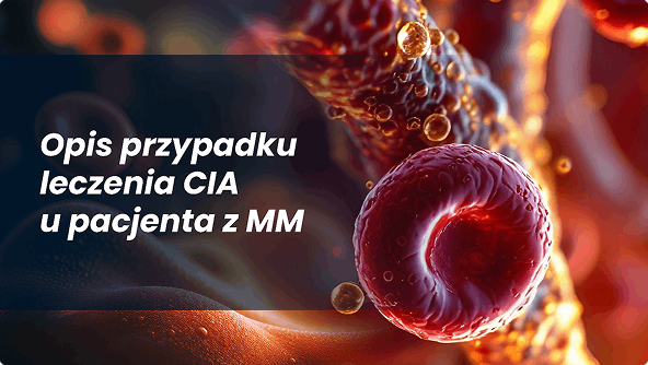 Opis przypadku leczenia CIA u pacjenta z MM